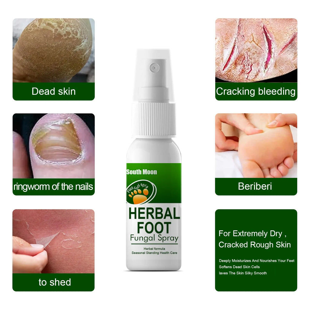 30ml bottle of foot nourishing and hydrating care spray with spray nozzle.