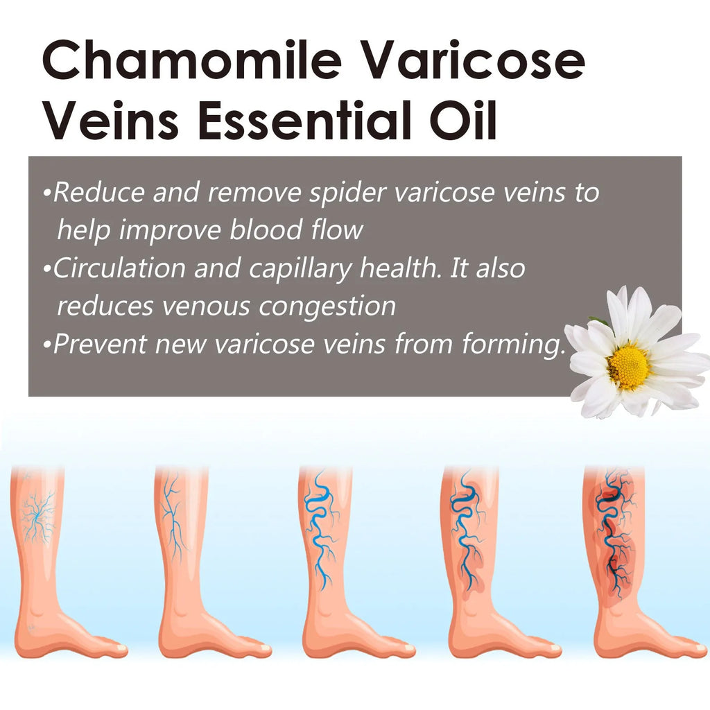 10ml bottle of chamomile essential oil for leg massage and skin care