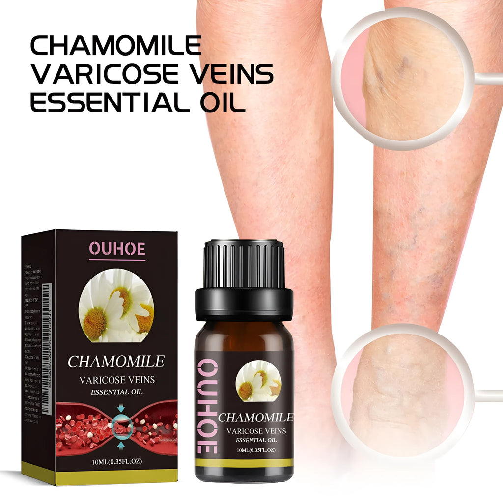 10ml bottle of chamomile essential oil for leg massage and skin care