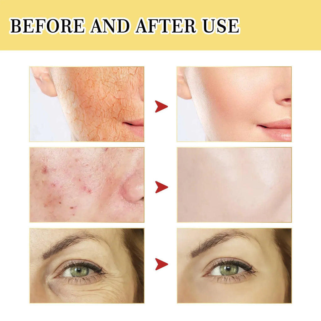 100ml bottle of Snail Serum Collagen Facial Serum for hydrating and brightening skin.