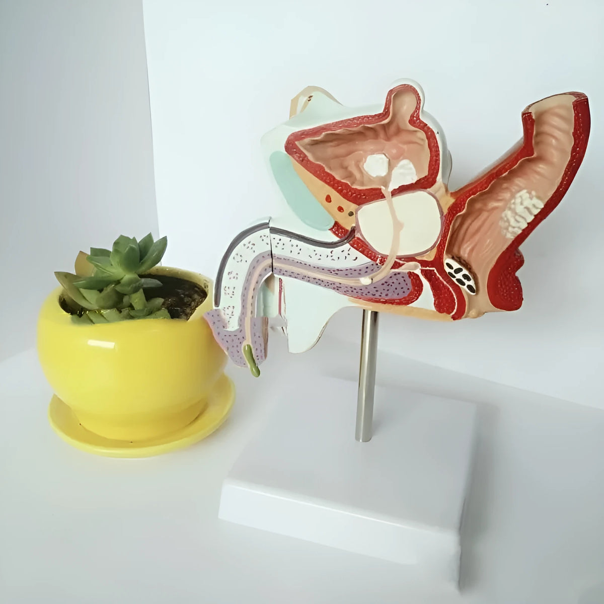 Plastic anatomical model of the male internal reproductive system showing listed diseases, 25.5 x 18 x 15 cm