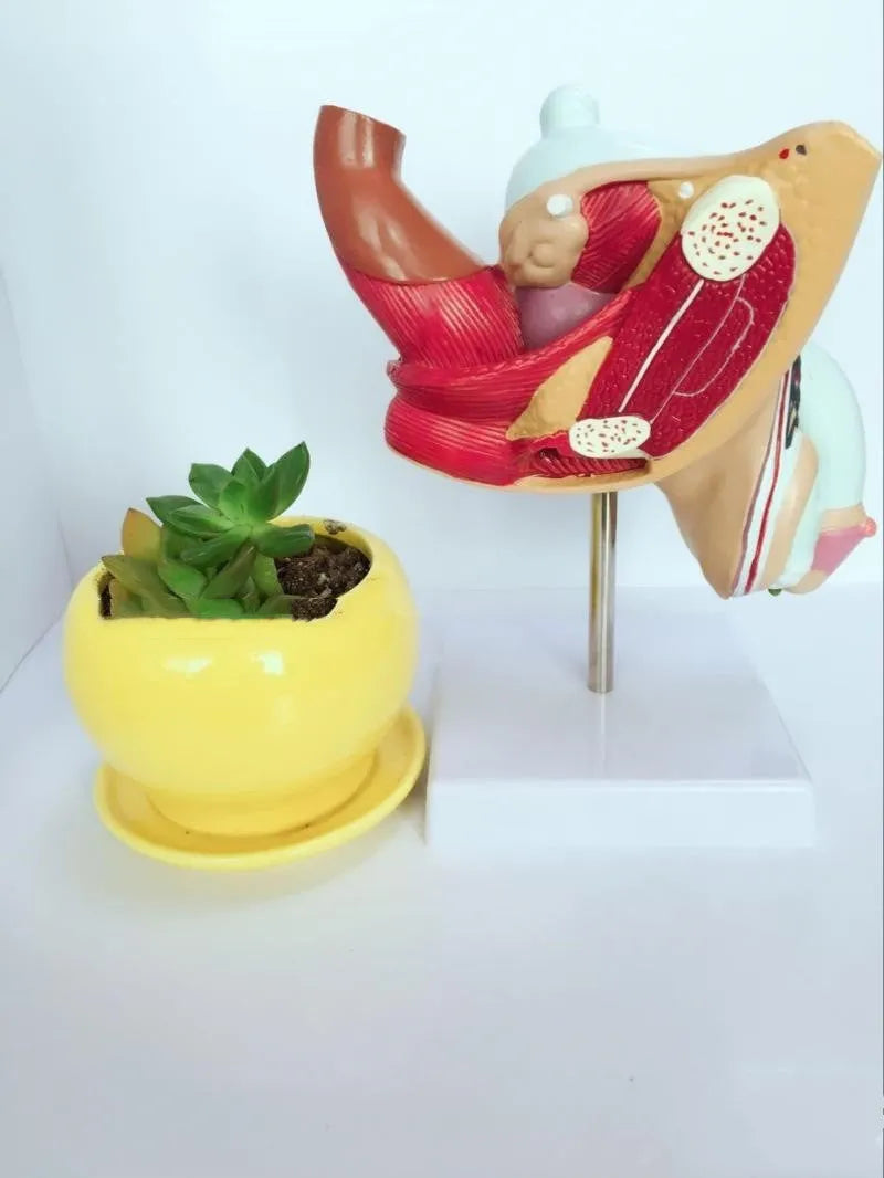 Plastic anatomical model of the male internal reproductive system showing listed diseases, 25.5 x 18 x 15 cm