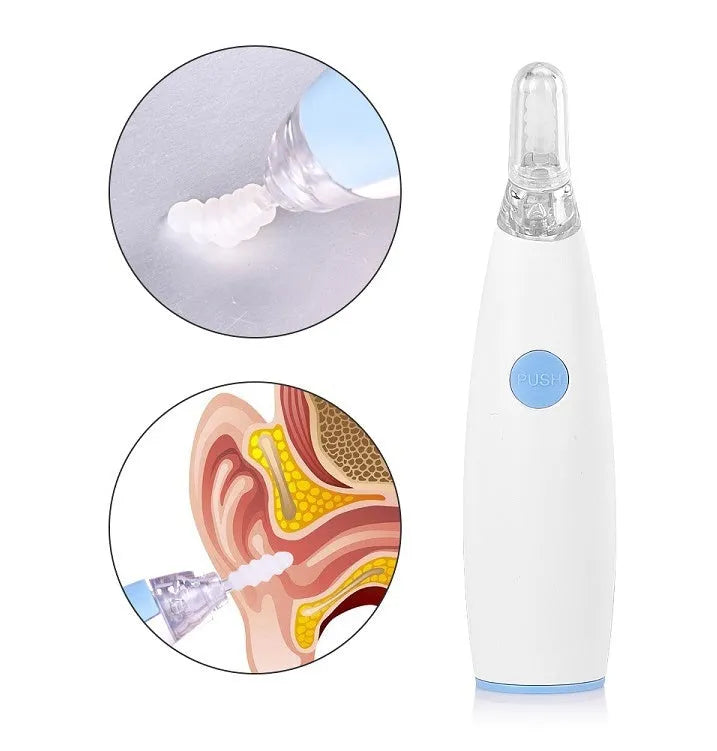 Rotating earwax vacuum cleaner with silicone spiral head, large blue handle, and LED light on display