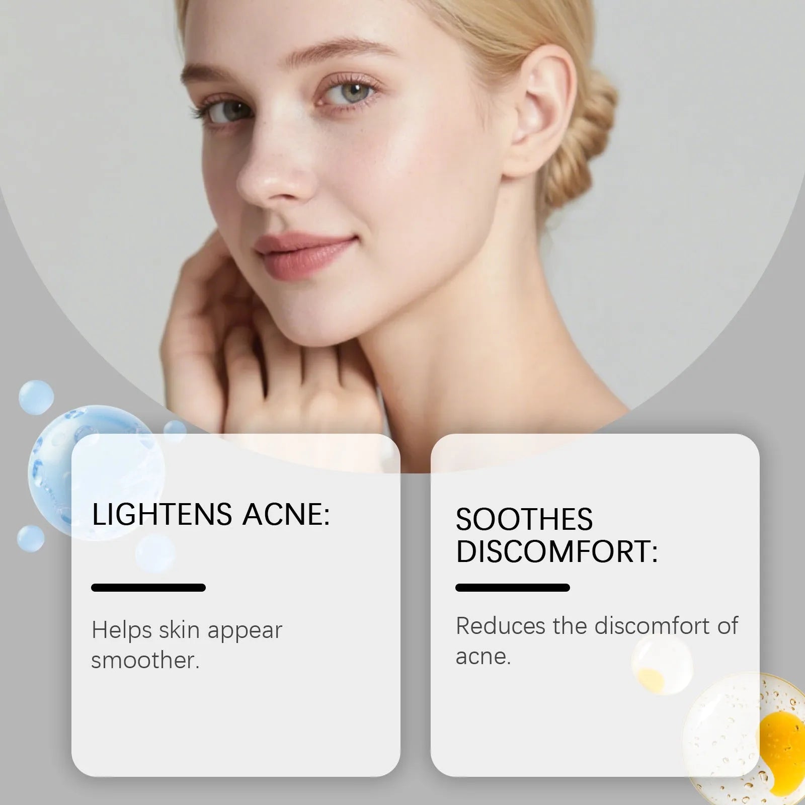 Pack of 80 transparent hydrocolloid facial acne patches for spot treatment