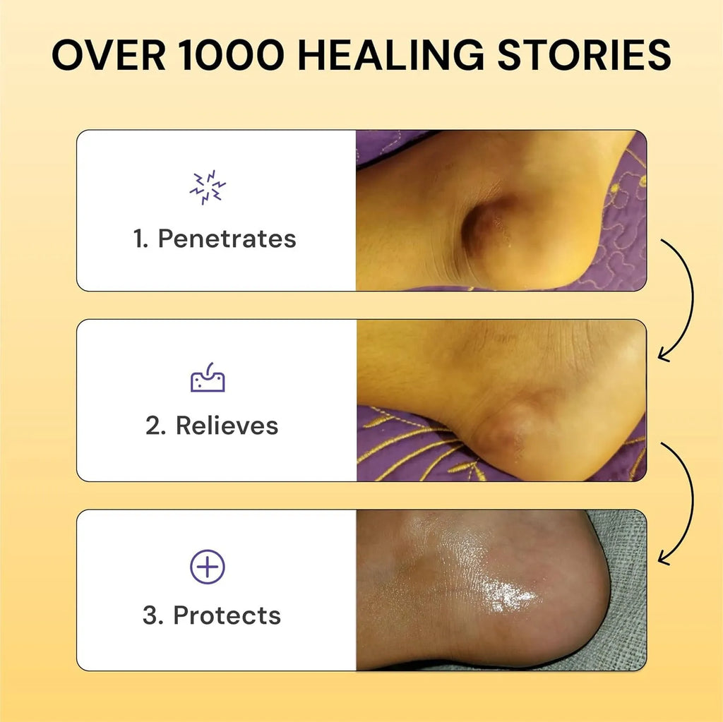 120g tube of Universal Flare Care muscle and joint pain relief cream with no logo